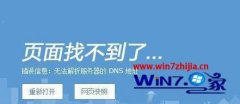 win10ϵͳʹѹʾ޷dnsַķ